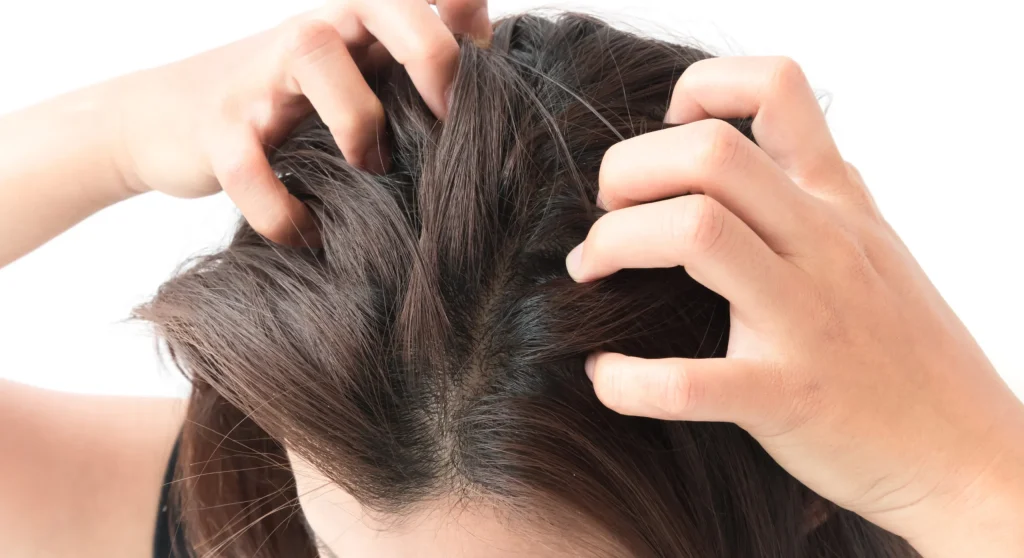 What's The Link Between Stress and Scalp Health- yaeli beauti